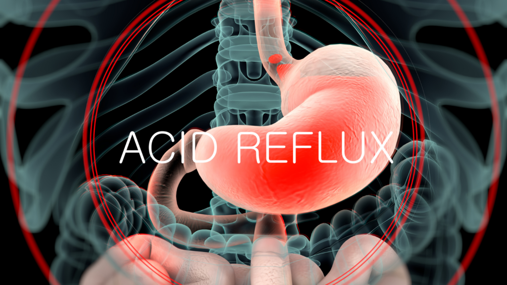 acid reflux breathing problems, acid reflux shortness breath, acid reflux respiratory symptoms, gerd breathing issues, acid reflux asthma, acid reflux cough, acid reflux lung problems, acid reflux treatment, gerd symptoms, acid reflux specialist