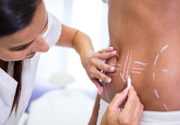trusculpt results, trusculpt body contouring, effective trusculpt, trusculpt before after, trusculpt side effects, trusculpt success rate, best trusculpt clinics, personalized trusculpt treatments, trusculpt cost, trusculpt testimonials